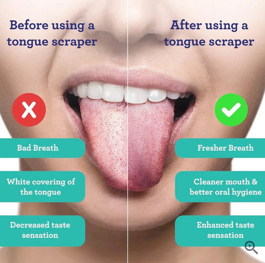 Tongue Scrapers Set (3 Pieces)